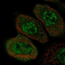 ZNF543 Antibody, Novus Biologicals 0.1mL; Unlabeled:Antibodies, Polyclonal